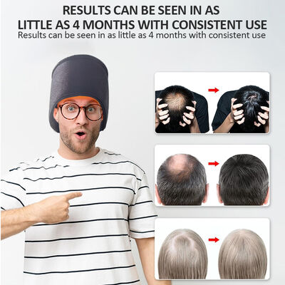 660nm हेयर ग्रोथ कैप एलईडी रेड लाइट थेरेपी और 270 एलईडी रेड लाइट और लेजर थेरेपी कैप